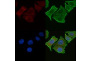 ABIN6262532 and ABIN6276906 staining Hela cells by IF/ICC. (IL-10RA anticorps  (C-Term))