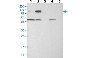 Western blot analysis of Lane 1: RT-4, Lane 2: U-251 MG, Lane 3: Human Plasma, Lane 4: Liver, Lane 5: Tonsil with IGSF9 polyclonal antibody . (IGSF9 anticorps)