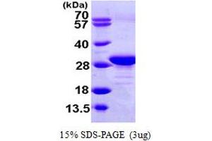 SDS-PAGE (SDS) image for Eukaryotic Translation Elongation Factor 1 beta 2 (EEF1B2) (AA 1-225) protein (His tag) (ABIN7529169)