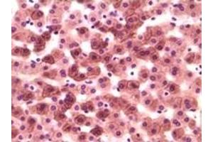 Immunohistochemistry (IHC) image for anti-Casein Kinase 1, alpha 1 (CSNK1A1) (truncated) antibody (ABIN2464037)