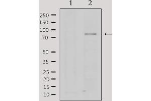 anti-Protein Arginine Methyltransferase 5 (PRMT5) (Internal Region) antibody