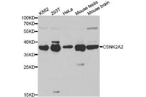 Western blot analysis of extracts of various cell lines, using CSNK2A2 antibody. (CSNK2A2 anticorps  (AA 1-350))