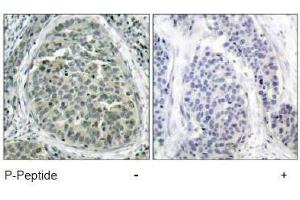 Image no. 1 for anti-Catenin (Cadherin-Associated Protein), beta 1, 88kDa (CTNNB1) (pSer37) antibody (ABIN196958) (CTNNB1 anticorps  (pSer37))