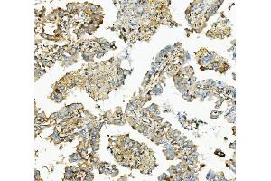 IHC analysis of Hexokinase 1/HK1 using anti-Hexokinase 1/HK1 antibody (ABIN7600259).