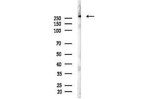 Western blot analysis of lysates from Hela cells(heat-shock, 45 min treatment), using POLR2A Antibody at 1/1000 dilution.