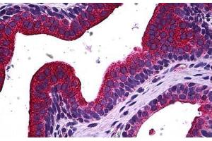 Human Prostate: Formalin-Fixed, Paraffin-Embedded (FFPE) (MAPK13 anticorps  (AA 251-365))