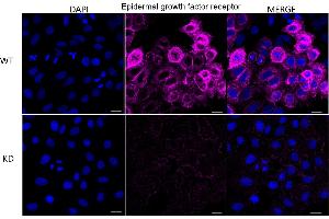 Immunocytochemical staining of HepG2 cells using Epidermal growth factor receptor antibody (ABIN7798473), 1:1,000), Top panel: wild-type (WT), Bottom panal: Adiponectin receptor 1 shRNA knockdown (KD). (EGFR anticorps)