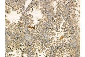 FAS Mouse Monoclonal Antibody at 1/100 staining mouse testis tissue by IHC-P. (FAS anticorps)