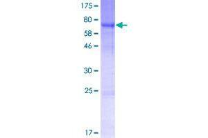 Image no. 1 for Sushi-Repeat Containing Protein, X-Linked 2 (SRPX2) (AA 1-465) protein (GST tag) (ABIN1321365)