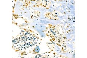 Immunohistochemistry of paraffin embedded mouse bone injury using SP7 (ABIN7075694) at dilution of 1:200 (400x lens)