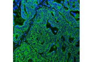 IF analysis of SUCLG2 using anti-SUCLG2 antibody (ABIN7601694). (SUCLG2 anticorps  (AA 42-424))