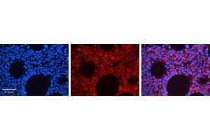 Rabbit Anti-MAPK14 Antibody  AV Formalin Fixed Paraffin Embedded Tissue: Human Bone Marrow Tissue Observed Staining: Cytoplasm, Nucleus Primary Antibody Concentration: 1:100 Other Working Concentrations: 1:600 Secondary Antibody: Donkey anti-Rabbit-Cy3 Secondary Antibody Concentration: 1:200 Magnification: 20X Exposure Time: 0.