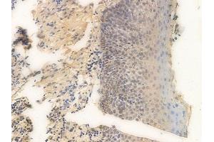 ABIN6265700 and ABIN6266665 at 1/100 staining human normal tonsil tissue by IHC-P. (TRADD anticorps  (N-Term))