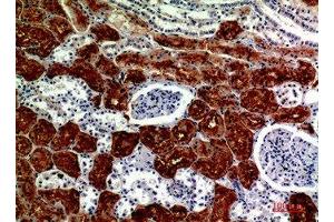 Immunohistochemical analysis of paraffin-embedded human-kidney, antibody was diluted at 1:200 (DROSHA anticorps  (Internal Region))