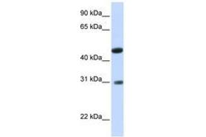 Image no. 1 for anti-Glycolipid Transfer Protein Domain Containing 2 (GLTPD2) (AA 36-85) antibody (ABIN6740898) (GLTPD2 anticorps  (AA 36-85))