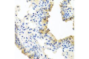 Immunohistochemistry of paraffin-embedded mouse lung using FECH antibody (ABIN6130423, ABIN6140573, ABIN6140574 and ABIN6224474) at dilution of 1:100 (40x lens).