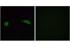 Immunofluorescence analysis of A549 cells, using OR2J2 Antibody. (OR2J2 anticorps  (AA 263-312))
