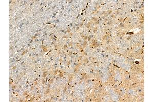 ABIN6259497 and ABIN6275092 at 1/100 staining Rat brain tissue by IHC-P.