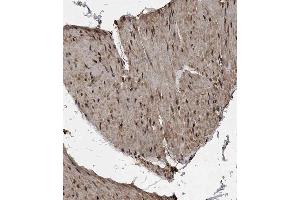 Immunohistochemical analysis of B on paraffin-embedded Human bladder tissue. (MET10 (AA 444-472), (C-Term) anticorps)