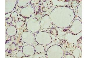 Immunohistochemistry of paraffin-embedded human thyroid tissue using ABIN7161975 at dilution of 1:100 (NOL4L (AA 101-300) anticorps)