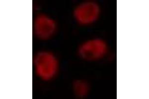 ABIN6274356 staining COLO205 cells by IF/ICC. (HLX anticorps  (Internal Region))