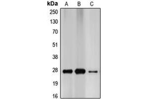 Western blot analysis of p27 Kip1 expression in MCF7 (A), HEK293T (B), PC12 (C) whole cell lysates. (CDKN1B anticorps  (C-Term))