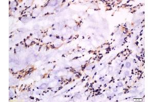 Formalin-fixed and paraffin embedded rat rectum labeled with Anti-GSDMA Polyclonal Antibody, Unconjugated  at 1:300 followed by conjugation to the secondary antibody and DAB staining. (Gasdermin A anticorps  (AA 21-120))