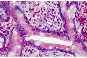 Human Small Intestine: Formalin-Fixed, Paraffin-Embedded (FFPE) (Caspase 7 anticorps)