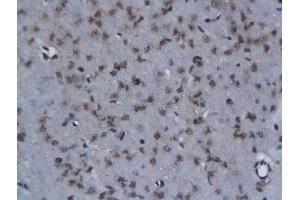 Formalin-fixed and paraffin embedded rat brain labeled with Anti- NIT2 Polyclonal Antibody, Unconjugated  followed by conjugation to the secondary antibody and DAB staining