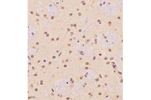 Immunohistochemistry of paraffin embedded rat brain using SR140 (ABIN7076091) at dilution of 1:1000 (400x lens) (SR140 anticorps)