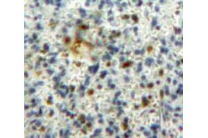 IHC-P analysis of Spleen tissue, with DAB staining. (GM-CSF anticorps  (AA 18-144))