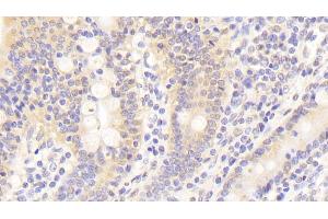 Detection of KNG1 in Human Small intestine Tissue using Polyclonal Antibody to Kininogen 1 (KNG1)
