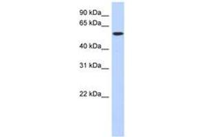 Image no. 1 for anti-Deoxynucleotidyltransferase, terminal (DNTT) (C-Term) antibody (ABIN6743611) (TdT anticorps  (C-Term))