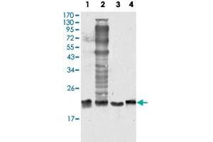 Western blot analysis of SOD1 monoclonal antobody, clone 6F5  against HeLa (1), NIH/3T3 (2), A-549 (3) and A-431 (4) cell lysate. (SOD1 anticorps)