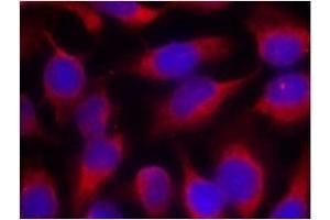 Image no. 1 for anti-Myristoylated Alanine-Rich Protein Kinase C Substrate (MARCKS) (Ser158) antibody (ABIN197560)