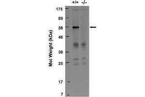 Immunoblot against lysates from wild-type (+/+) and RGS14 knockout (-/-) mouse brains probed with N133/21.
