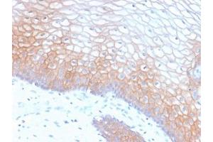 Formalin-fixed, paraffin-embedded human cervix stained with recombinant E-Cadherin antibody (clone CDH1/2208R).