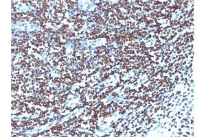 Formalin-fixed, paraffin-embedded human Tonsil stained with Histone H1 Mouse Monoclonal Antibody (1415-1)