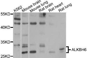 Western blot analysis of extracts of various cells, using ALKBH6 antibody. (ALKBH6 anticorps)