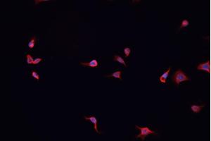 ABIN6267044 staining A-431 cells by IF/ICC. (NF-kB p65 anticorps  (C-Term))
