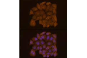 Immunofluorescence analysis of HeLa cells using Galectin 3/LG Rabbit mAb (ABIN7267337) at dilution of 1:50 (40x lens).