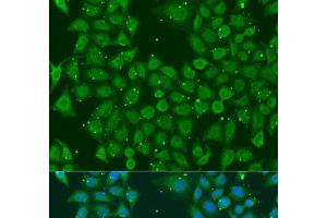 Immunofluorescence analysis of U2OS cells using AKR7A3 Polyclonal Antibody at dilution of 1:100. (AKR7A3 anticorps)