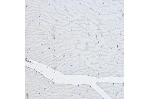 Immunohistochemistry of paraffin-embedded rat skeletal muscle using  Rabbit pAb (ABIN6127422, ABIN6136487, ABIN6136489 and ABIN6216551) at dilution of 1:500 (40x lens).