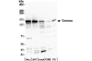 Western Blotting (WB) image for anti-Timeless Homolog (TIMELESS) (C-Term) antibody (ABIN7454703)