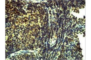 Immunohistochemistry (IHC) image for anti-Toll-Like Receptor 8 (TLR8) antibody (ABIN3179059) (TLR8 anticorps)