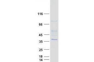 Validation with Western Blot