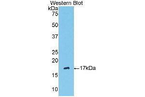Western Blotting (WB) image for anti-Serpin Peptidase Inhibitor, Clade G (C1 Inhibitor), Member 1 (SERPING1) (AA 397-495) antibody (ABIN3208985) (SERPING1 anticorps  (AA 397-495))