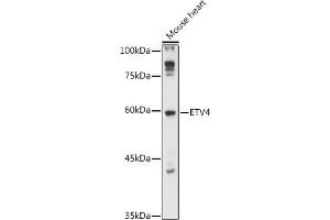 Western blot analysis of extracts of Mouse heart, using ETV4 antibody (ABIN6131216, ABIN6140331, ABIN6140333 and ABIN6218006) at 1:1000 dilution.