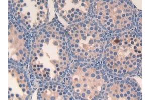 Detection of Slit3 in Mouse Testis Tissue using Polyclonal Antibody to Slit Homolog 3 (Slit3)
