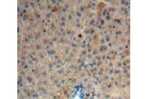 Used in DAB staining on fromalin fixed paraffin-embedded Liver tissue (HRG anticorps  (AA 106-302))